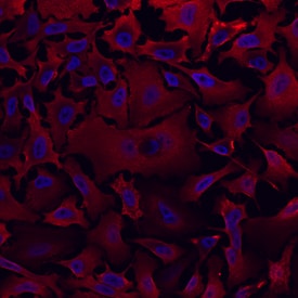 Aldehyde Dehydrogenase 1-A1/ALDH1A1 antibody in HeLa Human Cell Line by Immunocytochemistry (ICC).