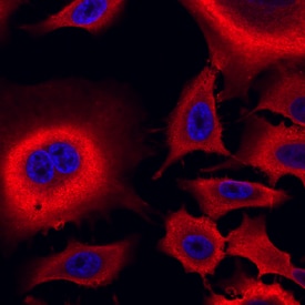 Aldehyde Dehydrogenase 1-A1/ALDH1A1 antibody in A549 Human Cell Line by Immunocytochemistry (ICC).