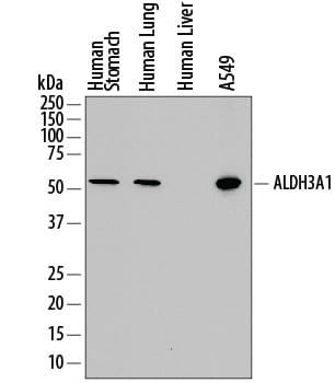 Detection of Human Aldehyde Dehydrogenase 3-A1/ALDH3A1 antibody by Western Blot.