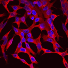 Aldo-keto Reductase 1C3/AKR1C3 antibody in LNCaP Human Cell Line by Immunocytochemistry (ICC).