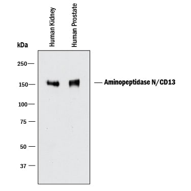 Detection of Human Aminopeptidase N/CD13 antibody by Western Blot.
