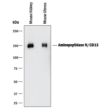Detection of Mouse Aminopeptidase N/CD13 antibody by Western Blot.
