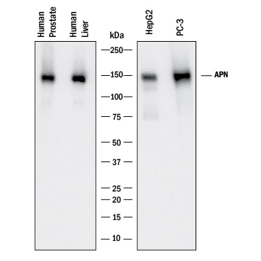 Detection of Human Aminopeptidase N/CD13 antibody by Western Blot.
