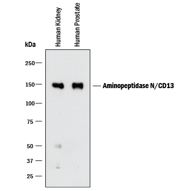 Detection of Human Aminopeptidase N/CD13 antibody by Western Blot.