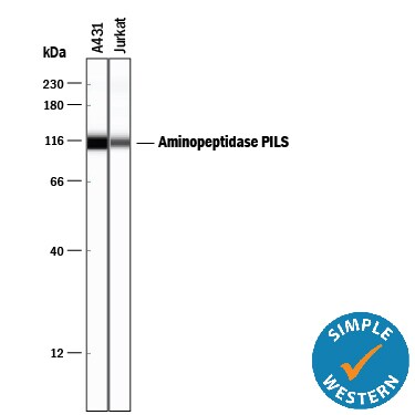 Detection of Human Aminopeptidase PILS/ARTS1 antibody by Simple WesternTM.