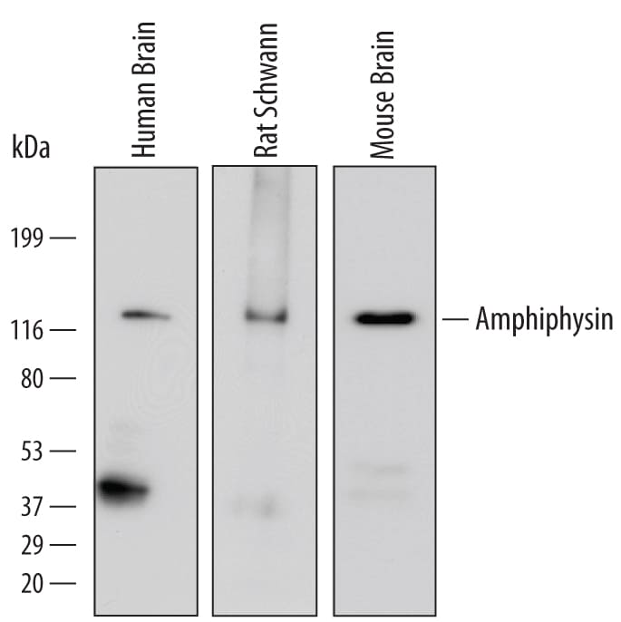 Detection of Human, Mouse, and Rat Amphiphysin/AMPH antibody by Western Blot.