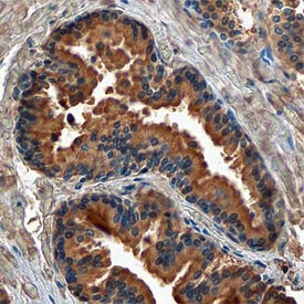 Androgen R/NR3C4 antibody in Human Prostate by Immunohistochemistry (IHC-P).