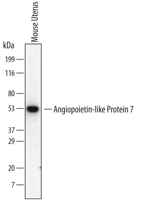 Detection of Mouse Angiopoietin-like Protein 7/ANGPTL7 antibody by Western Blot.