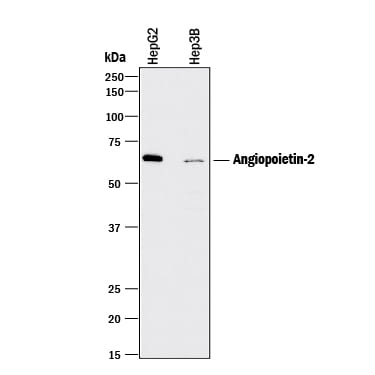 Detection of Human Angiopoietin-2 antibody by Western Blot.