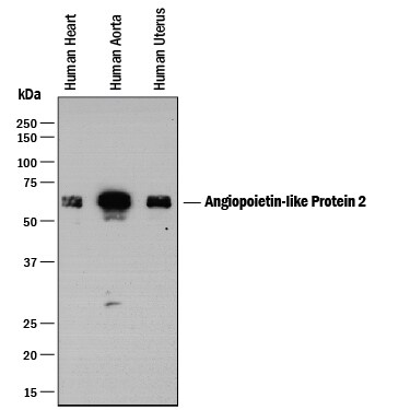 Detection of Human Angiopoietin‑like Protein 2/ANGPTL2 antibody by Western Blot.