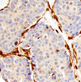 Annexin A1/Annexin I antibody in Human Breast by Immunohistochemistry (IHC-P).