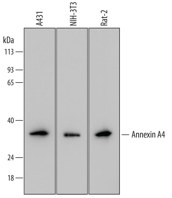 Detection of Human, Mouse, and Rat Annexin A4 antibody by Western Blot.