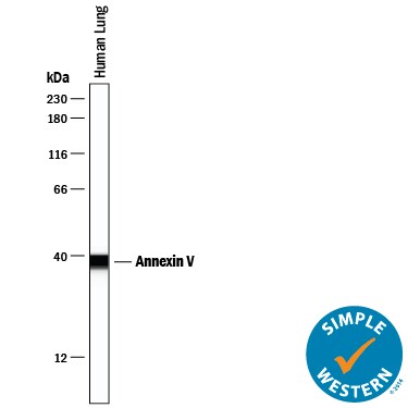Detection of Human Annexin V antibody by Simple WesternTM.