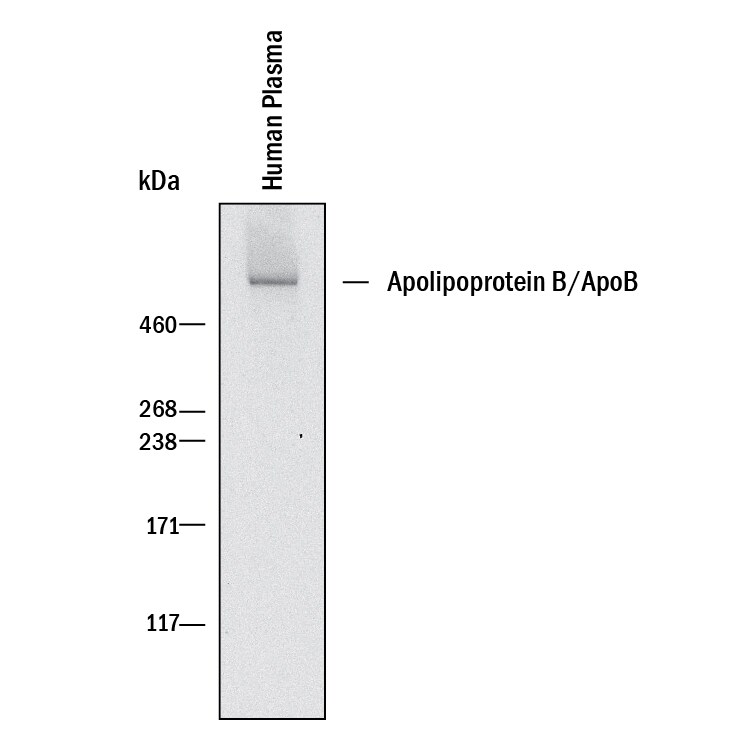 Detection of Human Apolipoprotein B/ApoB antibody by Western Blot.