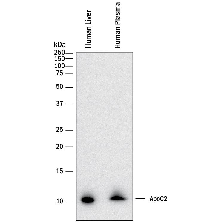 Detection of Human Apolipoprotein C-II/ApoC2 antibody by Western Blot.