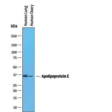 Detection of Human Apolipoprotein E/ApoE antibody by Western Blot.