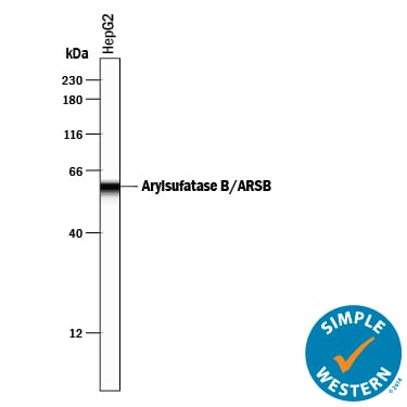 Detection of Human Arylsulfatase B/ARSB antibody by Simple WesternTM.