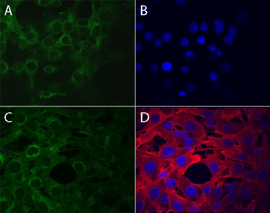 Phospho-Axl (Y779) antibody in A172 Human Cell Line by Immunocytochemistry (ICC).