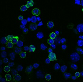 B220/CD45R antibody in Mouse Splenocytes by Immunocytochemistry (ICC).