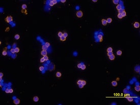 B220/CD45R antibody in Mouse Splenocytes by Immunocytochemistry (ICC).