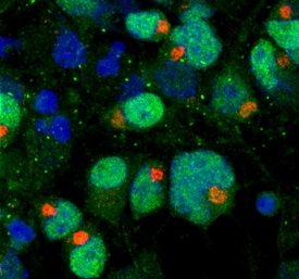 beta -1,3-Glucuronyltransferase 1/B3GAT1 antibody in Rat Cortical Stem Cells by Immunocytochemistry (ICC).