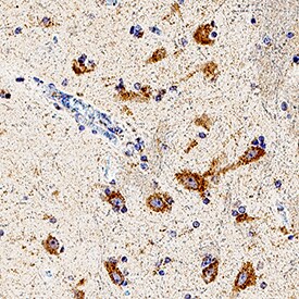 beta -1,3-Glucuronyltransferase 1/B3GAT1 antibody in Human Brain by Immunohistochemistry (IHC-P).