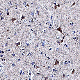 beta -1,3-Glucuronyltransferase 1/B3GAT1 antibody in Human Brain by Immunohistochemistry (IHC-P).