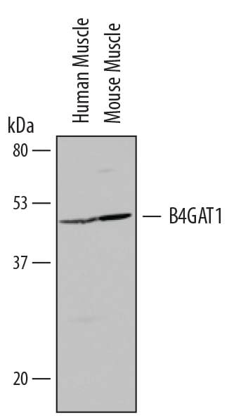 Detection of Human and Mouse  beta -1,4-Glucuronyltransferase 1/B4GAT1 antibody by Western Blot.