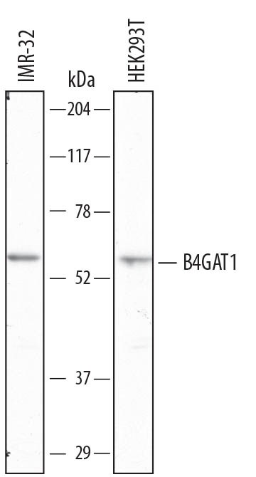 Detection of Human  beta -1,4-Glucuronyltransferase 1/B4GAT1 antibody by Western Blot.