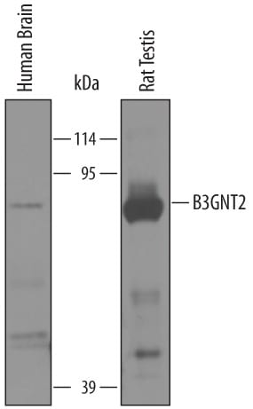 Detection of Human and Rat  beta -1,3-N-acetylglucosaminyl-transferase 2/B3GNT2 antibody by Western Blot.