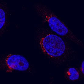 beta -1,4-Galactosyltransferase 1/B4GalT1 antibody in HeLa Human Cell Line by Immunocytochemistry (ICC).