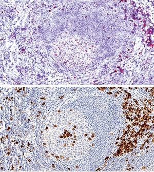 B7-1/CD80 antibody in Human Tonsil Using Dual RNAscope®ISH and IHC.