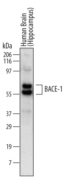 Detection of Human BACE‑1 antibody by Western Blot.