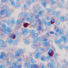 BAFF/BLyS/TNFSF13B antibody in Human Spleen by Immunohistochemistry (IHC-P).