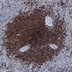 BAFF R/TNFRSF13C antibody in Human Spleen by Immunohistochemistry (IHC-P).