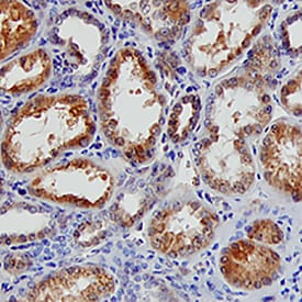 BAMBI/NMA antibody in Human Kidney by Immunohistochemistry (IHC-P).