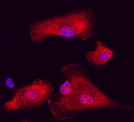 BAT3/BAG6 antibody in Human Dendritic Cells by Immunocytochemistry (ICC).
