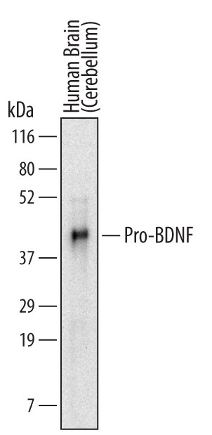 Detection of Human Pro-BDNF antibody by Western Blot.