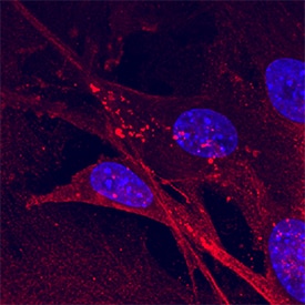 BNIP3L antibody in HeLa Human Cell Line by Immunocytochemistry (ICC).