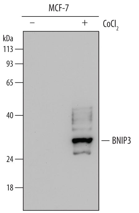 Detection of Human BNIP3 antibody by Western Blot.