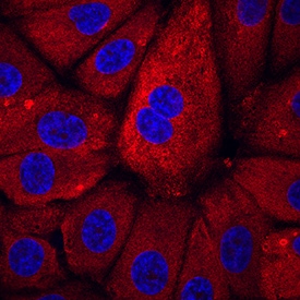 BNP antibody in BG01V Human Cells by Immunocytochemistry (ICC).