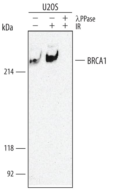 Detection of Human Phospho-BRCA1 (S1423) antibody by Western Blot.