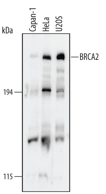 Detection of Human BRCA2 antibody by Western Blot.