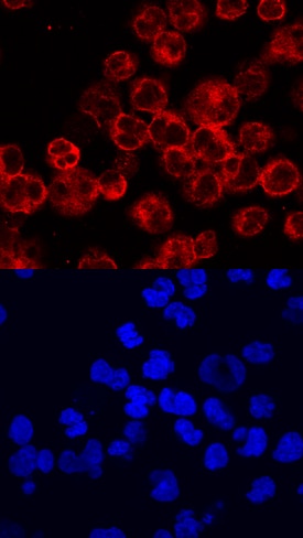 BTK antibody in Raji Human Cell Line by Immunocytochemistry (ICC).