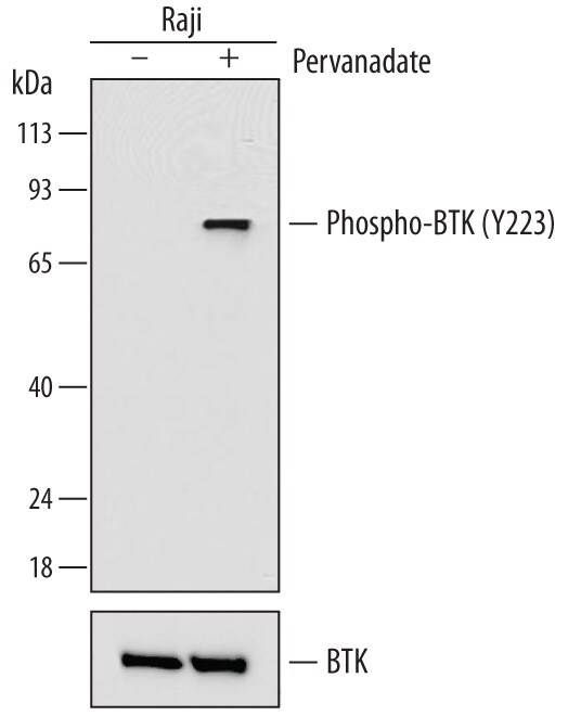 Detection of Human Phospho-BTK (Y223) antibody by Western Blot.