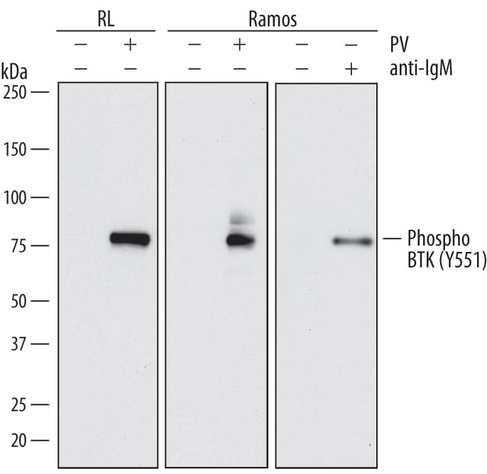 Detection of Human Phospho-BTK (Y551) antibody by Western Blot.