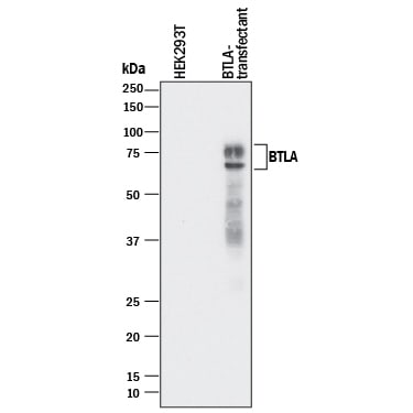 Detection of Human BTLA antibody by Western Blot.
