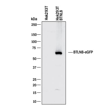 Detection of Human BTNL8 antibody by Western Blot.