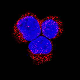 Bad antibody in Jurkat Human Cell Line by Immunocytochemistry (ICC).