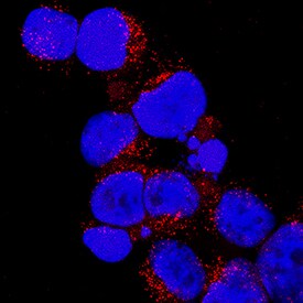Bad antibody in Jurkat Human Cell Line by Immunocytochemistry (ICC).